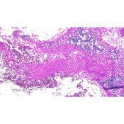 Tissue Control Slide, Fungi-PAS